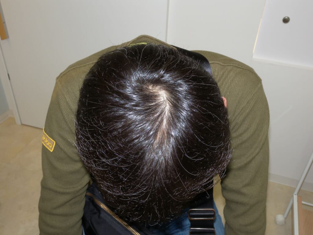 Oops Hairの治療実例画像