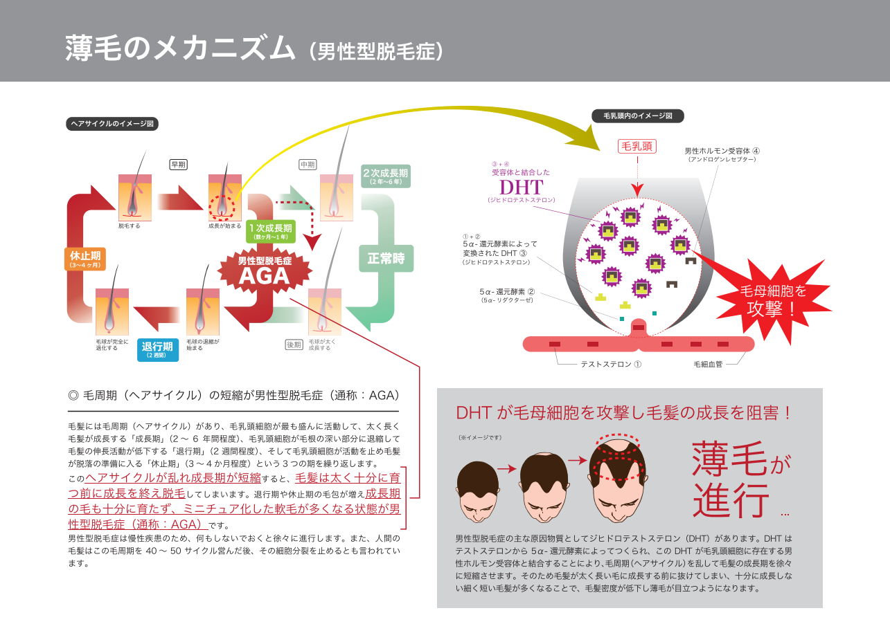 髪の毛 男性ホルモン 302473男性ホルモン 減らす 髪の毛